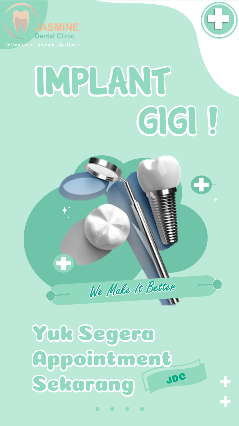 Promo Implant gigi